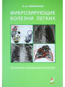 Фиброзирующие болезни легких. Роль рентгенолога в мультидисциплинарном консилиуме