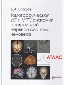 Томографическая (КТ и МРТ) анатомия центральной нервной системы человека. Атлас