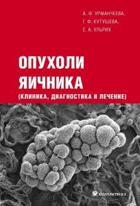 Опухоли яичника (клиника, диагностика и лечение)