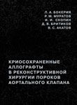 Криосохраненные аллографты в реконструктивной хирургии пороков аортального клапана