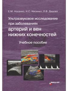 Ультразвуковое исследование при заболеваниях артерий и вен нижних конечностей. 