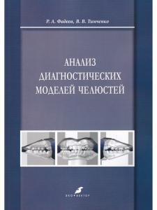 Анализ диагностических моделей челюстей