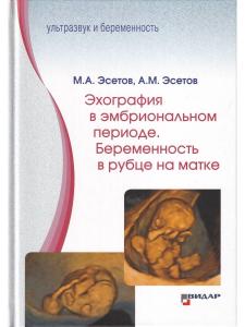 Эхография в эмбриональном периоде. Беременность в рубце на матке