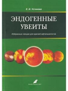 Эндогенные увеиты