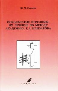 Оскольчатые переломы: их лечение по методу академика Г.А. Илизарова