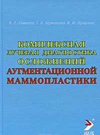 Комплексная лучевая диагностика осложнений аугментационной маммопластики. Руководство для врачей.
