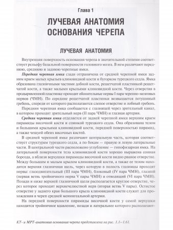 Лучевая диагностика оснований черепа и мостмозжечкового угла