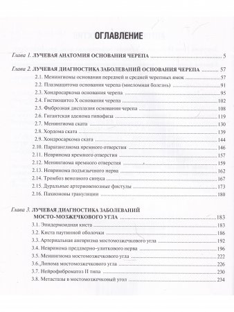 Лучевая диагностика оснований черепа и мостмозжечкового угла