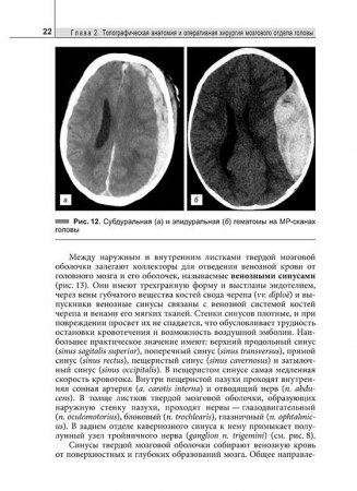Клиническая анатомия головы и шеи
