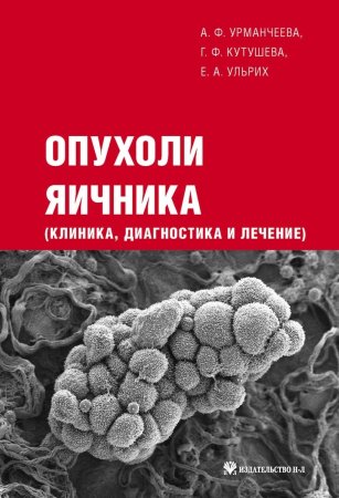 Опухоли яичника (клиника, диагностика и лечение)