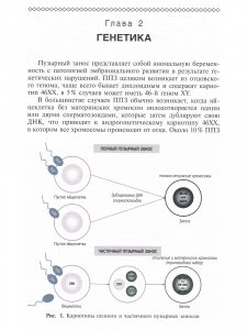 Трофобластическая болезнь, справочник
