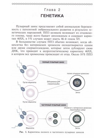 Трофобластическая болезнь, справочник