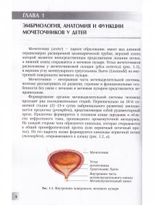 Мегауретер у новорожденных и детей раннего возраста