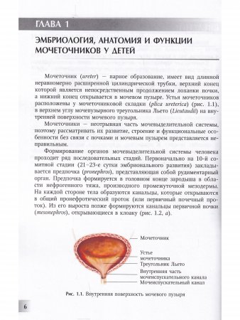 Мегауретер у новорожденных и детей раннего возраста