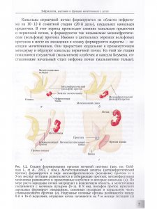 Мегауретер у новорожденных и детей раннего возраста