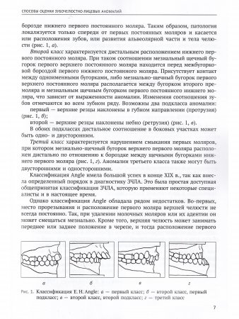 Количественная оценка зубочелюстно-лицевых аномалий