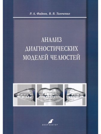 Анализ диагностических моделей челюстей