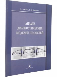 Анализ диагностических моделей челюстей