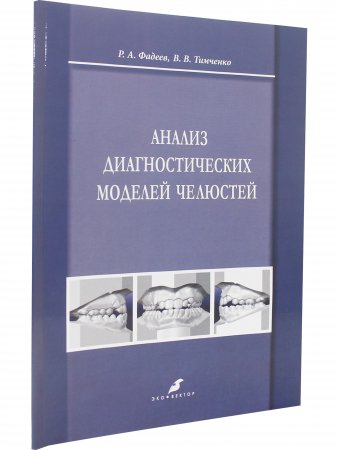 Анализ диагностических моделей челюстей