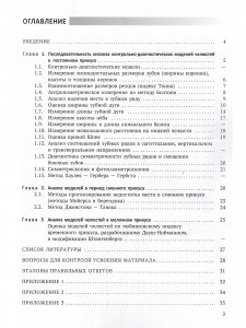 Анализ диагностических моделей челюстей