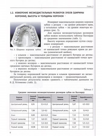 Анализ диагностических моделей челюстей