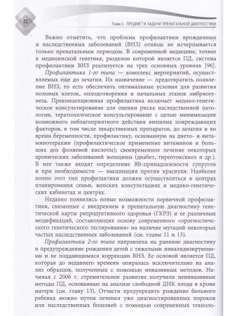 Пренатальная диагностика наследственных болезней. Состояние и перспективы.
