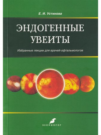 Эндогенные увеиты