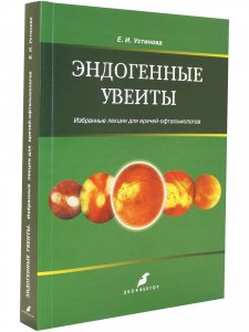Эндогенные увеиты