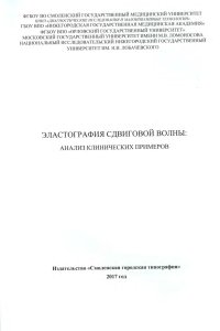 Эластография сдвиговой волны: анализ клинических примеров