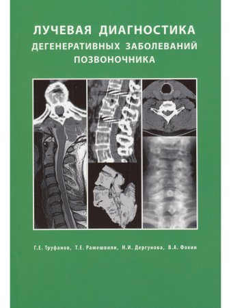 Лучевая диагностика  дегенеративных заболеваний позвоночника 3-е излание