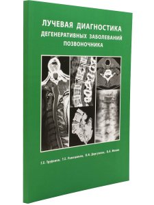 Лучевая диагностика  дегенеративных заболеваний позвоночника 3-е излание