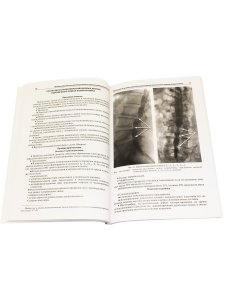 Лучевая диагностика  дегенеративных заболеваний позвоночника 3-е излание