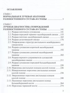 Лучевая диагностика заболеваний голеностопного сустава и стопы