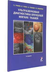 Ультразвуковая диагностика опухолей мягких тканей. 4-е издание