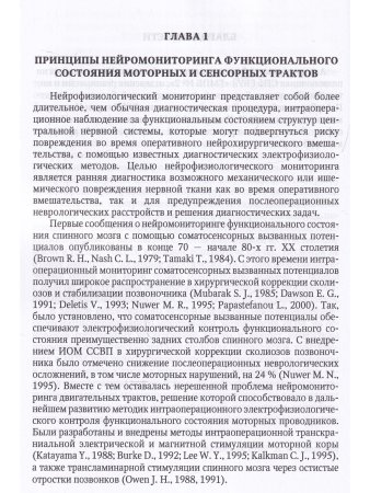 Электрофизиологический мониторинг центральной нервной системы