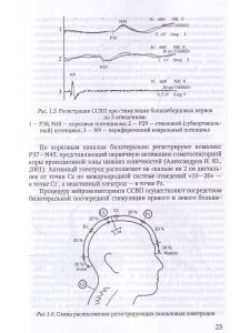 Электрофизиологический мониторинг центральной нервной системы