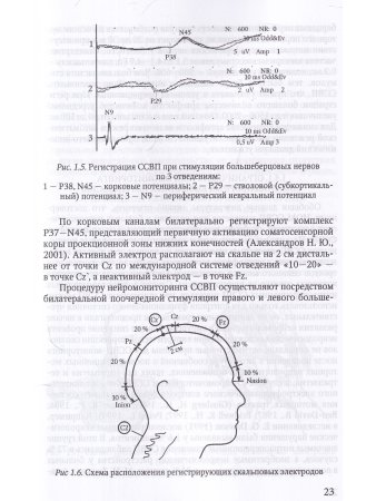 Электрофизиологический мониторинг центральной нервной системы