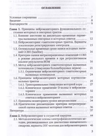Электрофизиологический мониторинг центральной нервной системы