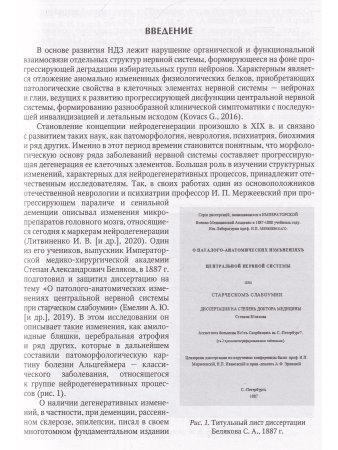 Нейродегенеративные заболевания (патогенез,клиника,диагностика,терапия)