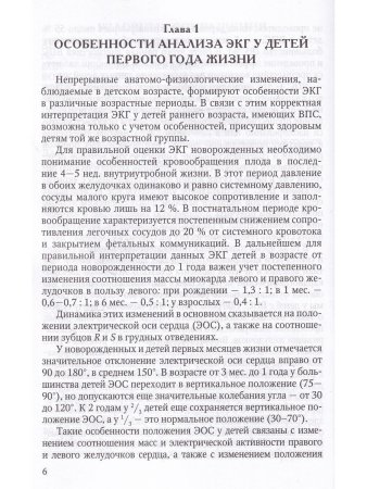 Анализ электрокардиограммы у детей раннего возраста с врожденными пороками сердца