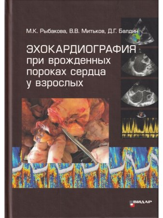 Эхокардиография при врожденных пороках сердца у взрослых