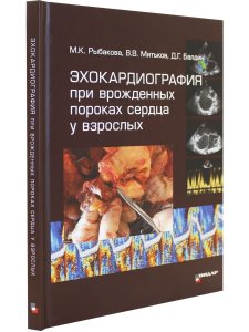 Эхокардиография при врожденных пороках сердца у взрослых