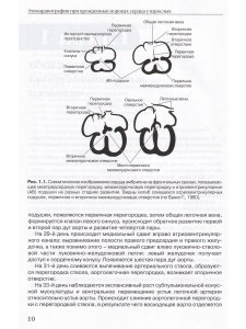 Эхокардиография при врожденных пороках сердца у взрослых