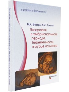 Эхография в эмбриональном периоде. Беременность в рубце на матке