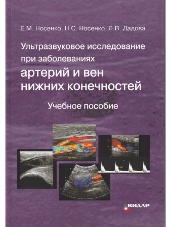 Ультразвуковое исследование при заболеваниях артерий и вен нижних конечностей. 