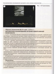 Ультразвуковое исследование при заболеваниях артерий и вен нижних конечностей. 