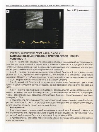 Ультразвуковое исследование при заболеваниях артерий и вен нижних конечностей. 