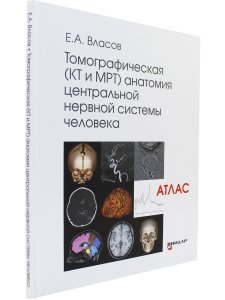 Томографическая (КТ и МРТ) анатомия центральной нервной системы человека. Атлас