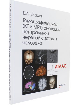 Томографическая (КТ и МРТ) анатомия центральной нервной системы человека. Атлас
