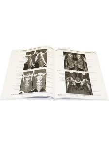 Томографическая (КТ и МРТ) анатомия центральной нервной системы человека. Атлас